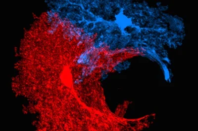 Carmichael-Cortical, Medical School photo