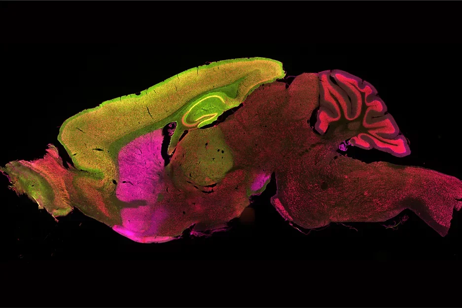 The cortex and striatum contribute to Huntington's Disease