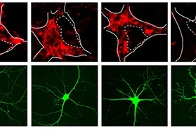 Guo Lab - Genes responsible for familial forms of Parkinson’s disease