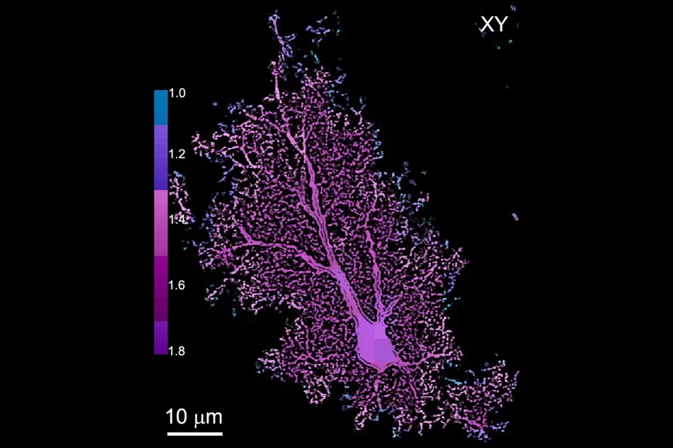 Glial cells - astrocytes and brain diseases