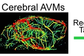 Vascular calcification compounds 