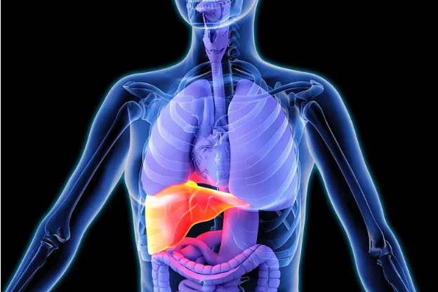 Acute Hepatitis Infection Graphic Illustration of Female with Inflamed Liver
