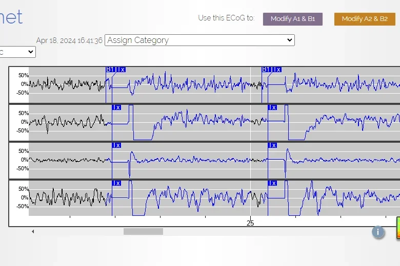 Image of EEG recordings