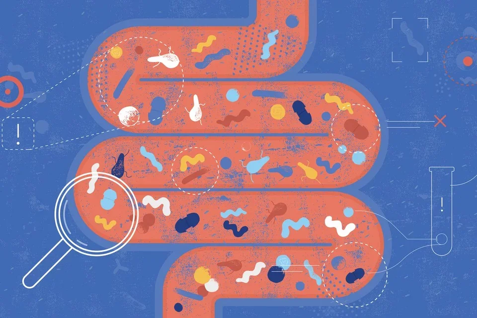 Enteral Nutrition Tube Feeding Graphic of Intestine
