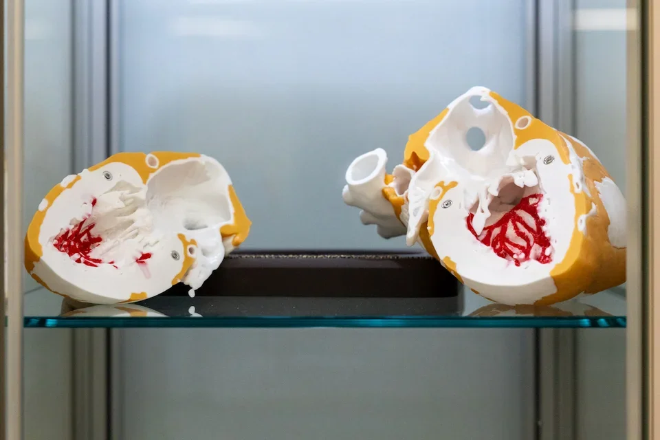 A heart model, printed with 3D technology