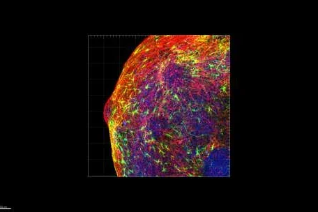 An organoid model of a human forebrain 