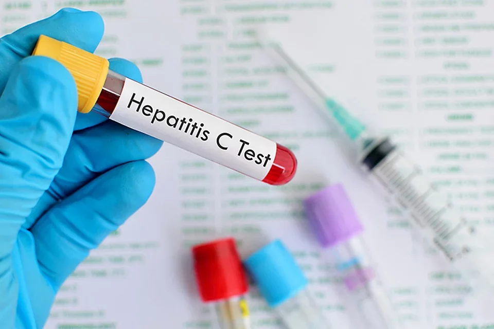 Hepatitis C Test Gloved Hand Holding Test Tube for Blood Test