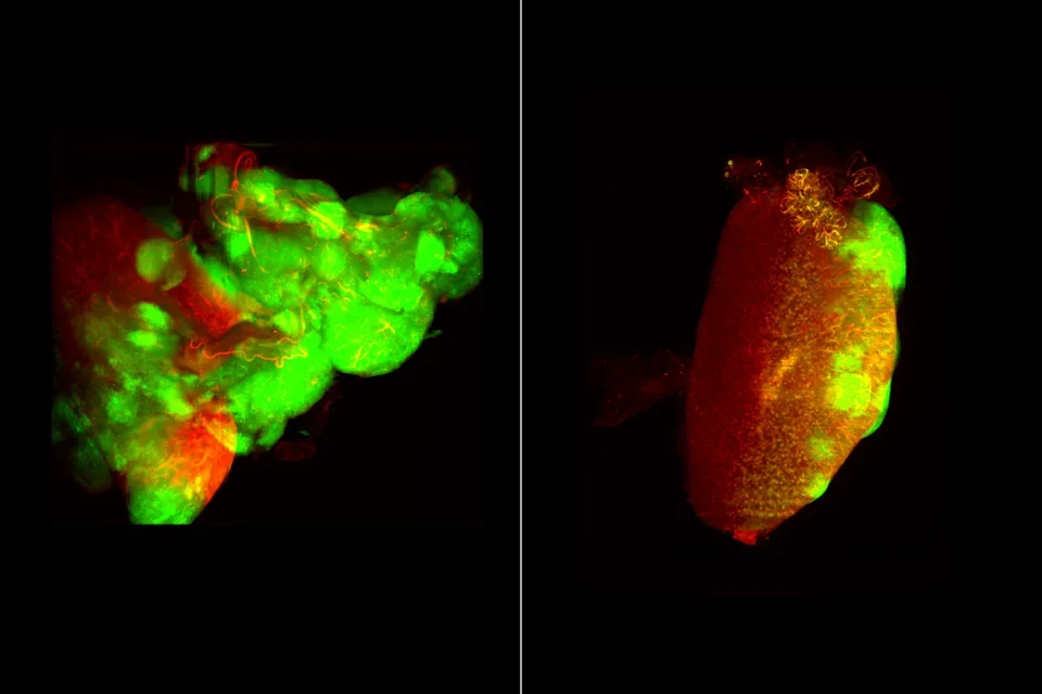Magnified view of kidney tumor cells before and after treatment. 