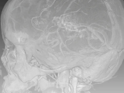 Brain Picture