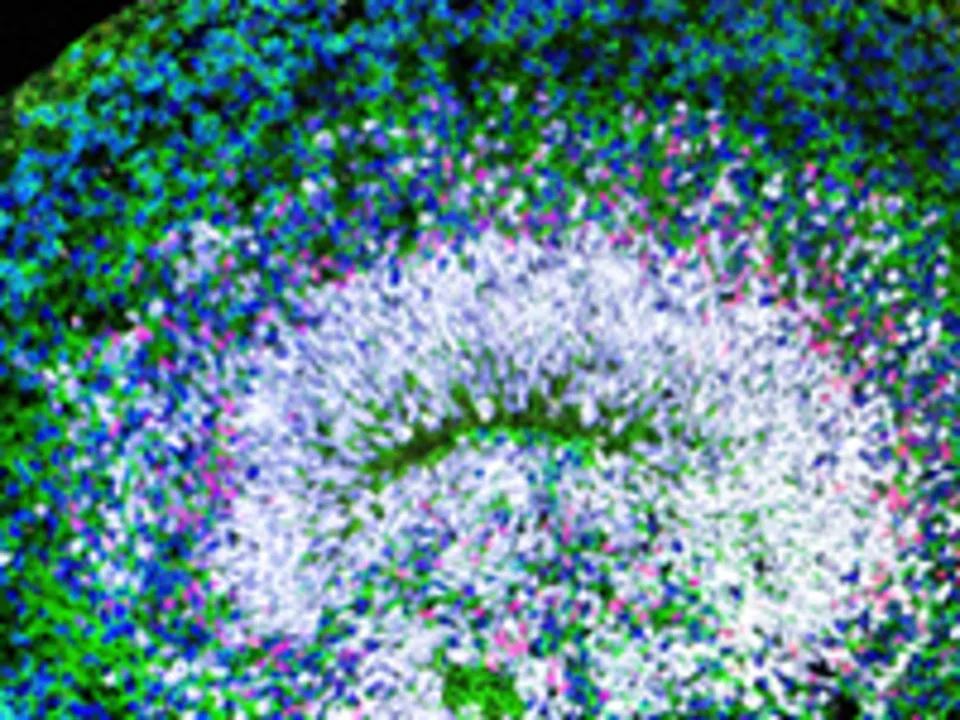 Cross section - organoid 2