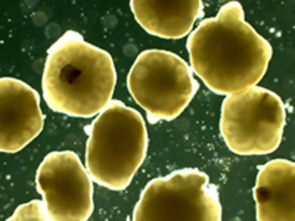 Organoids in a dish - stem cells