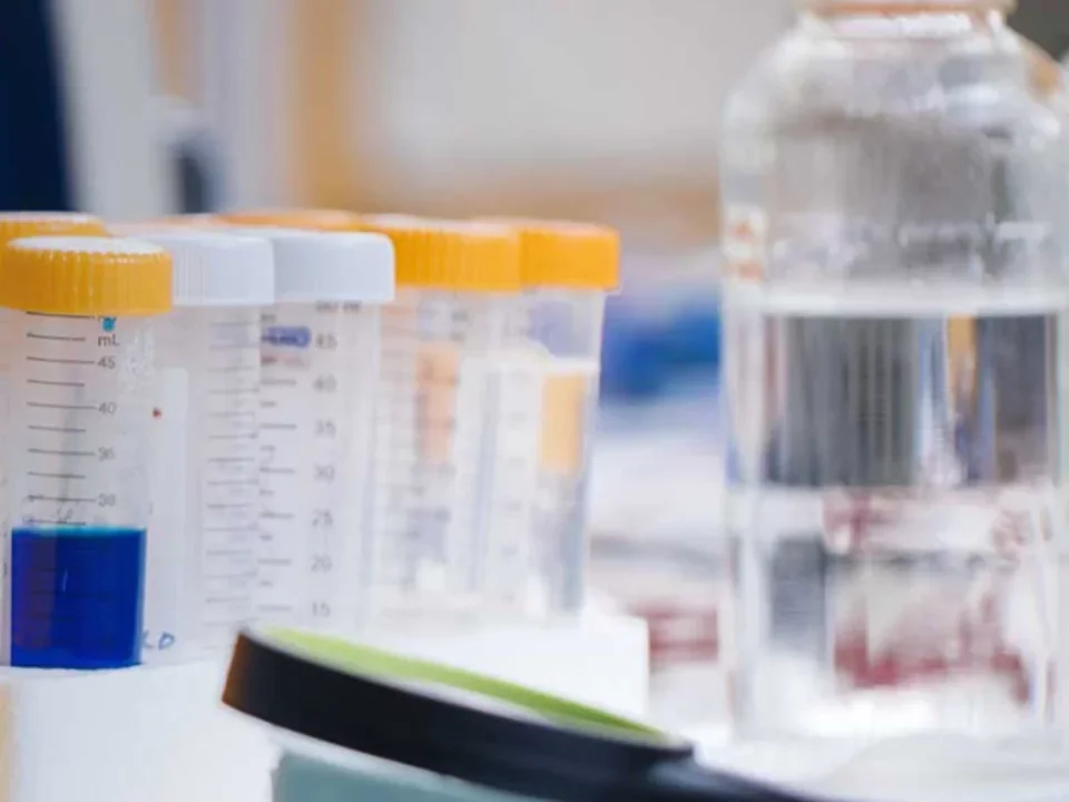 DISC4 oppportunity from CIRM