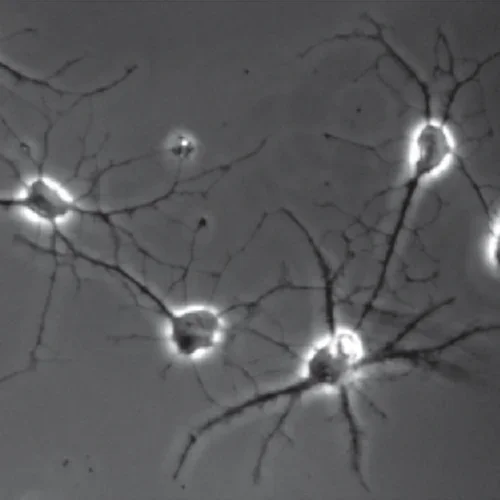Human Astrocyte - astrocytes and brain disorders