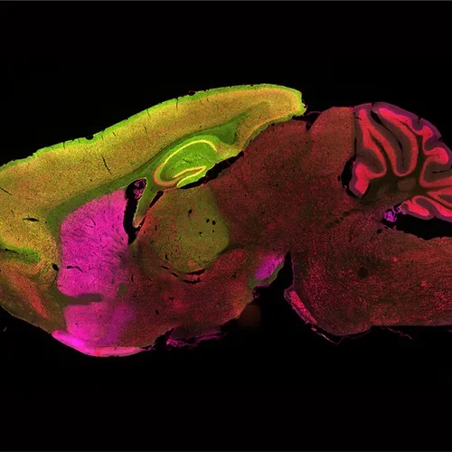 The cortex and striatum contribute to Huntington's Disease