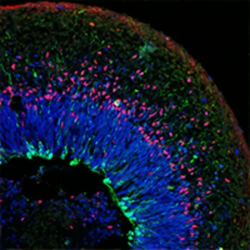 Cross section-organoid - stem cells