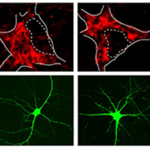 Guo Lab - Genes responsible for familial forms of Parkinson’s disease