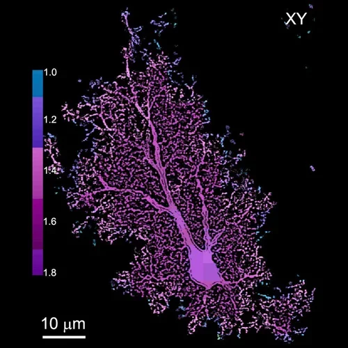 Glial cells - astrocytes and brain diseases