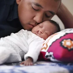 Baby with cleft lip