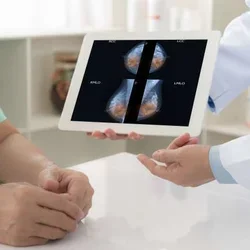 DESTINY-Breast04 Results are ‘Practice-Changing’