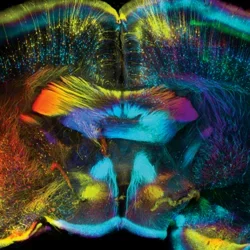 Grey Matters - The Lifetime of a Memory - Medical School composite