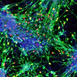 Sensory interneurons derived from mouse stem cells