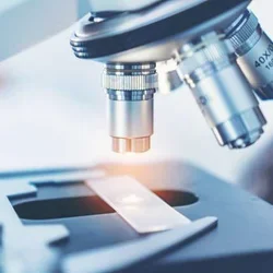 Steepest Annual Rise in Advanced Cervical Cancer