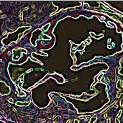 Lipoprotein