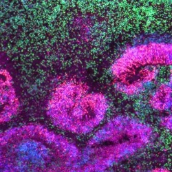Microscopy image of a cortical organoid, a stem cell-derived model that mimics the developing human brain. 