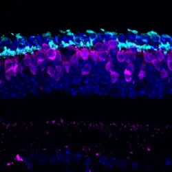 Cone photoreceptors in the degenerating retina