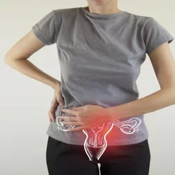 Endometriosis Symptoms Female with Pelvic Pain