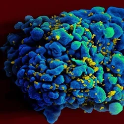 HIV infected H9 T-Cell NIAID