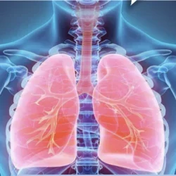 Lung x-ray