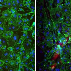 A microscopy still of human stem cell-derived mini heart organoids