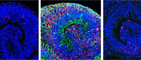 Before and After Zika Infection - Dying Stem Cells