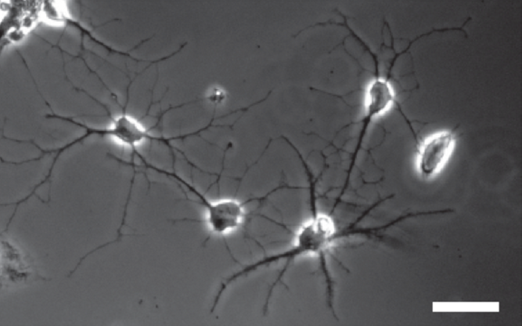 Human Astrocyte - astrocytes and brain disorders