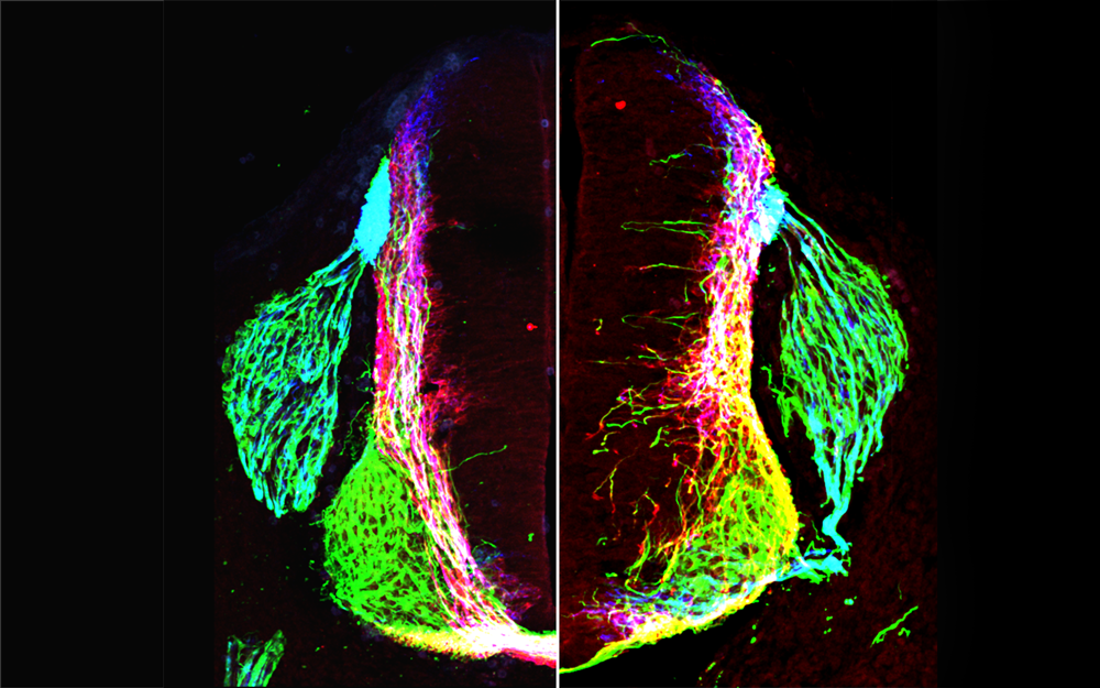 Transverse section of control or netrin1 mouse in neural circuits research