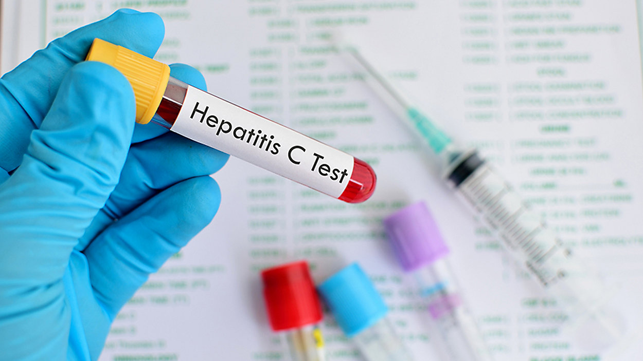 Hepatitis C Test Gloved Hand Holding Test Tube for Blood Test