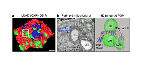 Mitochondria bound to lipid droplets in cells 