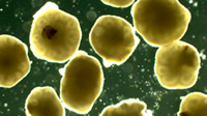 Organoids in a dish - stem cells