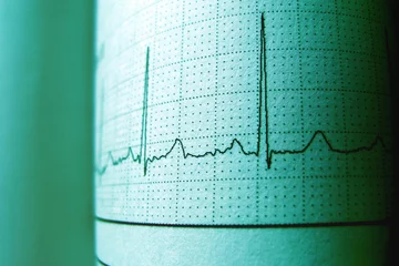 cardiac rate reading