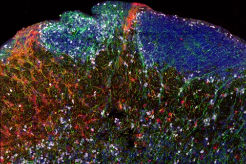 Fluorescent imaging of diverse cell types in a human brain section. (Oier Pastor-Alonso, UCSF)