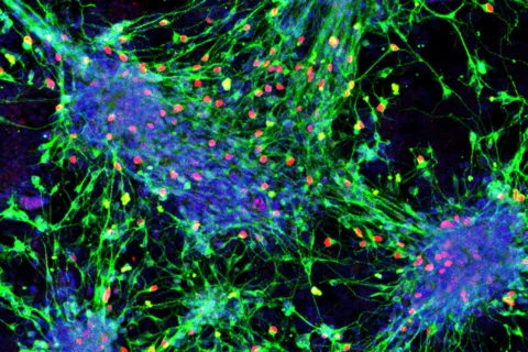Sensory interneurons derived from mouse stem cells