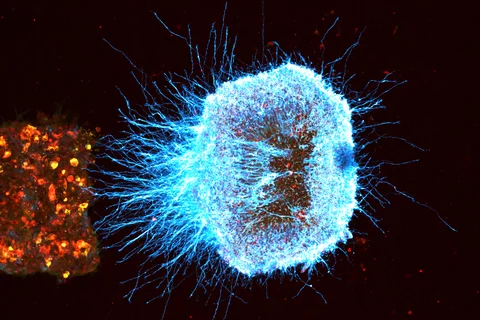 Microscopy image taken by Yesica Mercado