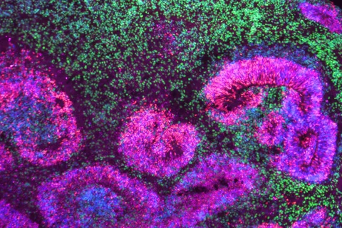 Alzheimer's research microscopy