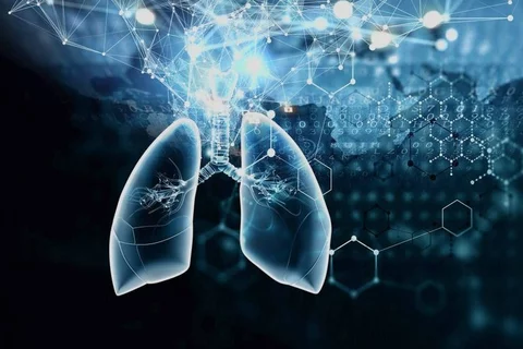 Digital/stylized pulmonary nodules.