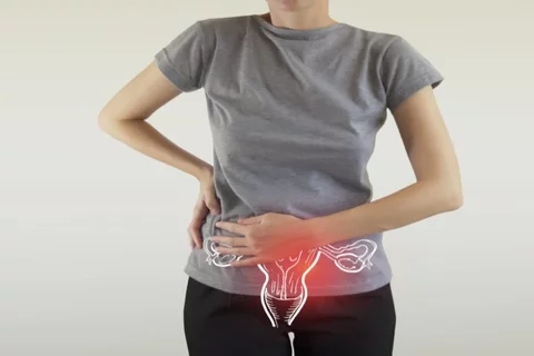 Endometriosis Symptoms Female with Pelvic Pain