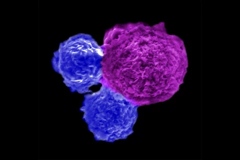 Blue iNKT cells attack a blood cancer cell