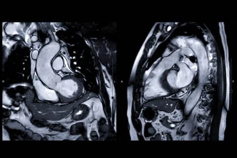 cardio MRI stock image