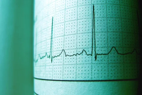 cardiac rate reading