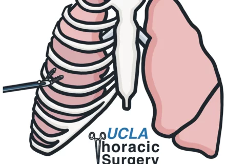 UCLA Thoracic Surgery Interest Group Logo